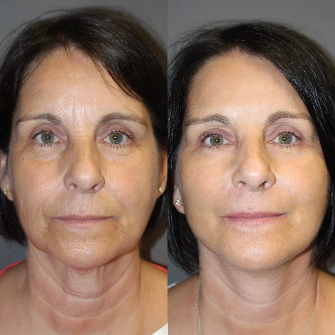 Morning Glow Routine