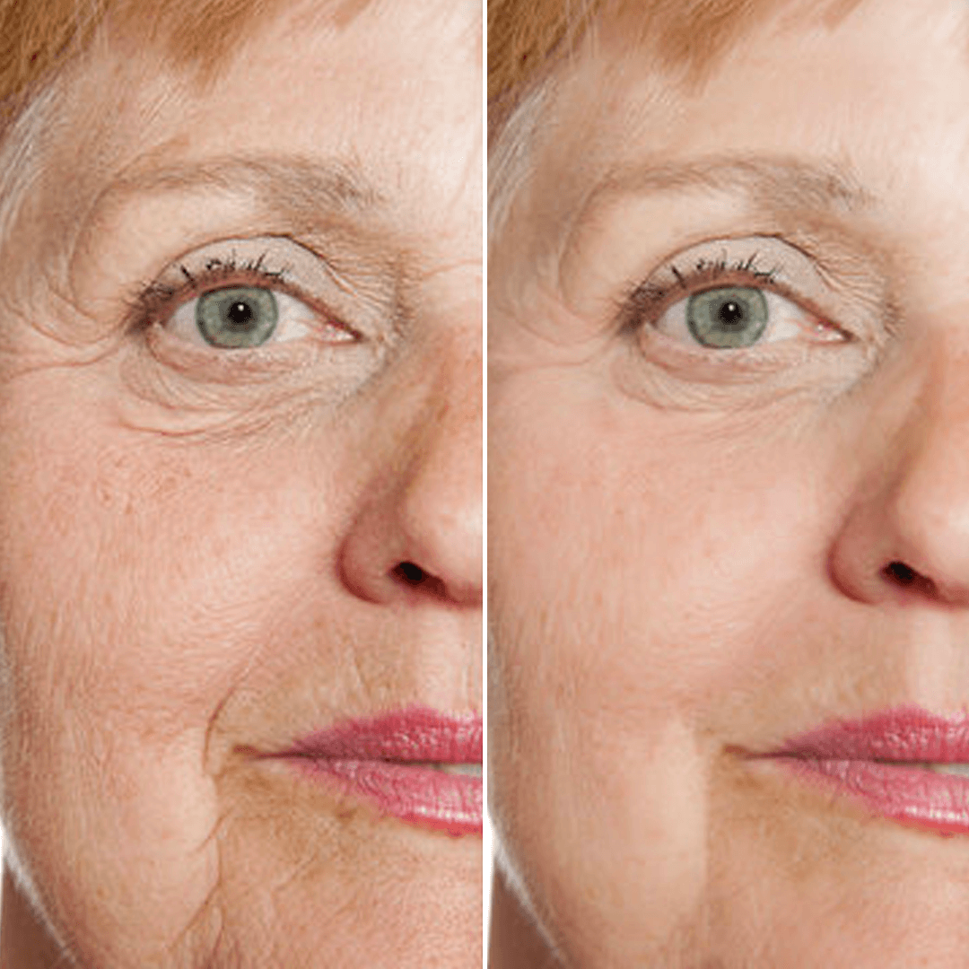 Rejuvenate Resurfacing Face Serum (3 Pack)