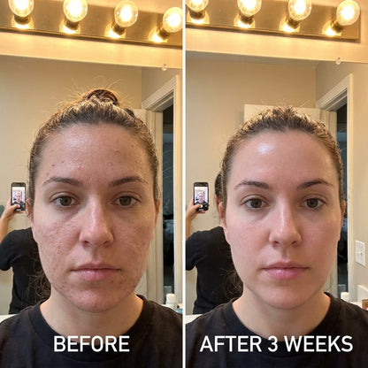 Rejuvenate Face Serum