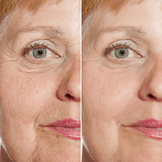 Resurfacing Face Serum