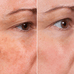 Resurfacing Face Serum main image 1